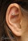 9852 outer conch piercing_piercing ucha