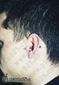 9996 horizontal industrial piercing(tragus piercing_inner conch piercing)_piercing ucha