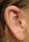 9860 forward helix piercing_piercing ucha