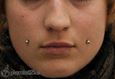 9944 cheek piercing_piercing rtu