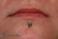 9960 labret piercing_piercing rtu