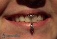 9972 smiley piercing_ center lip piercing_piercing rtu