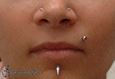 9982 madonna piercing_labret piercing_piercing rtu