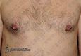 9823 nipple piercing_piercing bradavek