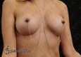 9844 nipple piercing_piercing bradavek