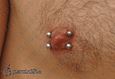 9970 double nipple surface piercing_piercing bradavky