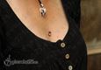 9906 microdermal