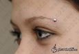 9914 microdermal