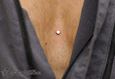 9926 microdermal