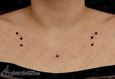 9932 surface piercing_ microdermal