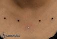 9934 microdermal