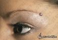 9938 microdermal