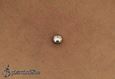 9940 microdermal