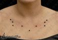 9946 surface piercing_microdermal