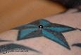 9948 microdermal