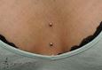 9954 microdermal