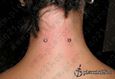 9982 nape piercing_surface piercing