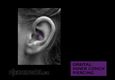 (21) orbital inner conch piercing