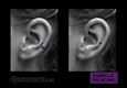 (1) auricle piercing
