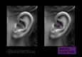 (2) daith piercing