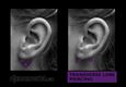 (7) transverse lobe piercing