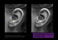 (11) forward helix piercing