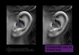 (11) forward helix piercing