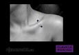 (2) clavicle piercing